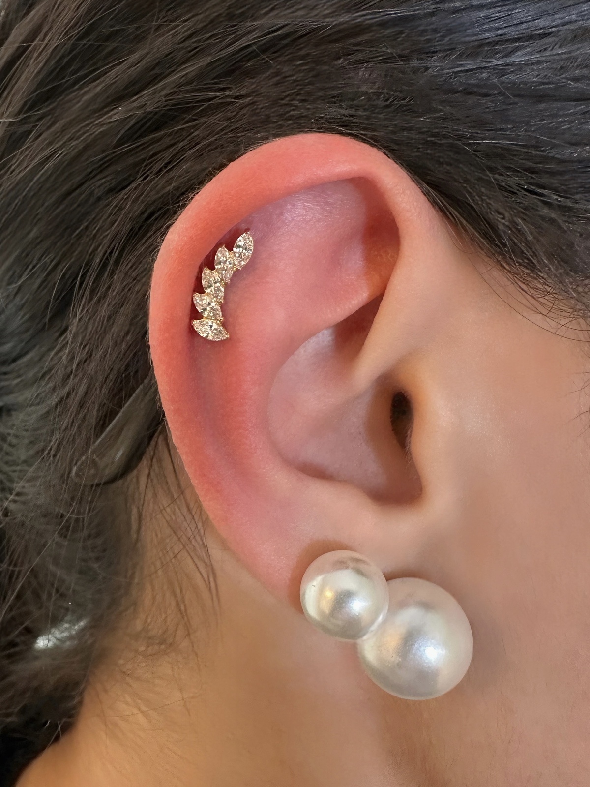 image00293
